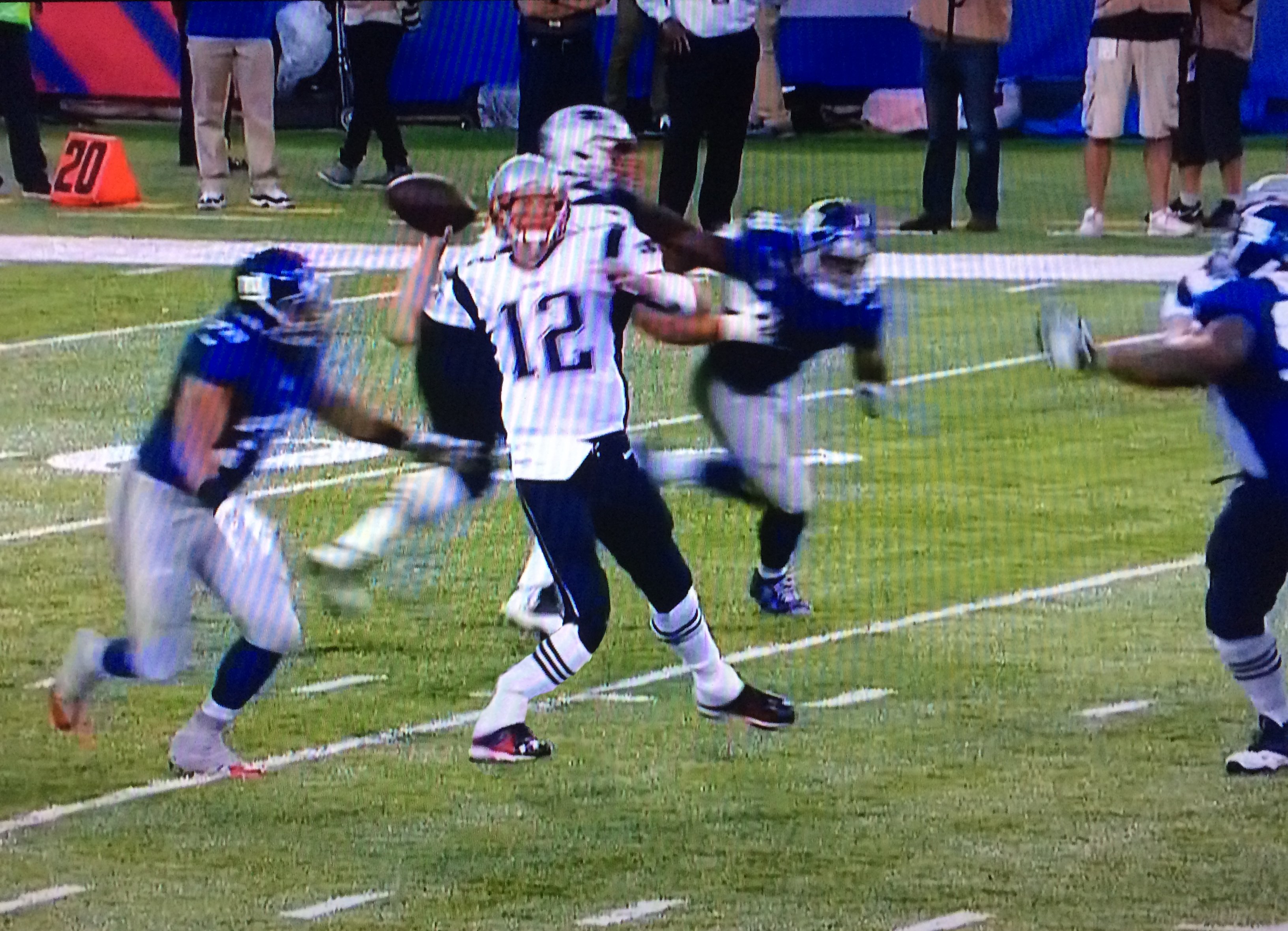 Tom Brady Suffers Gruesome Leg injury In Final Preseason Game Daily Snark