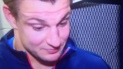 Gronk-Can-Barely-Contain-Himself-When-Reporter-Says-69