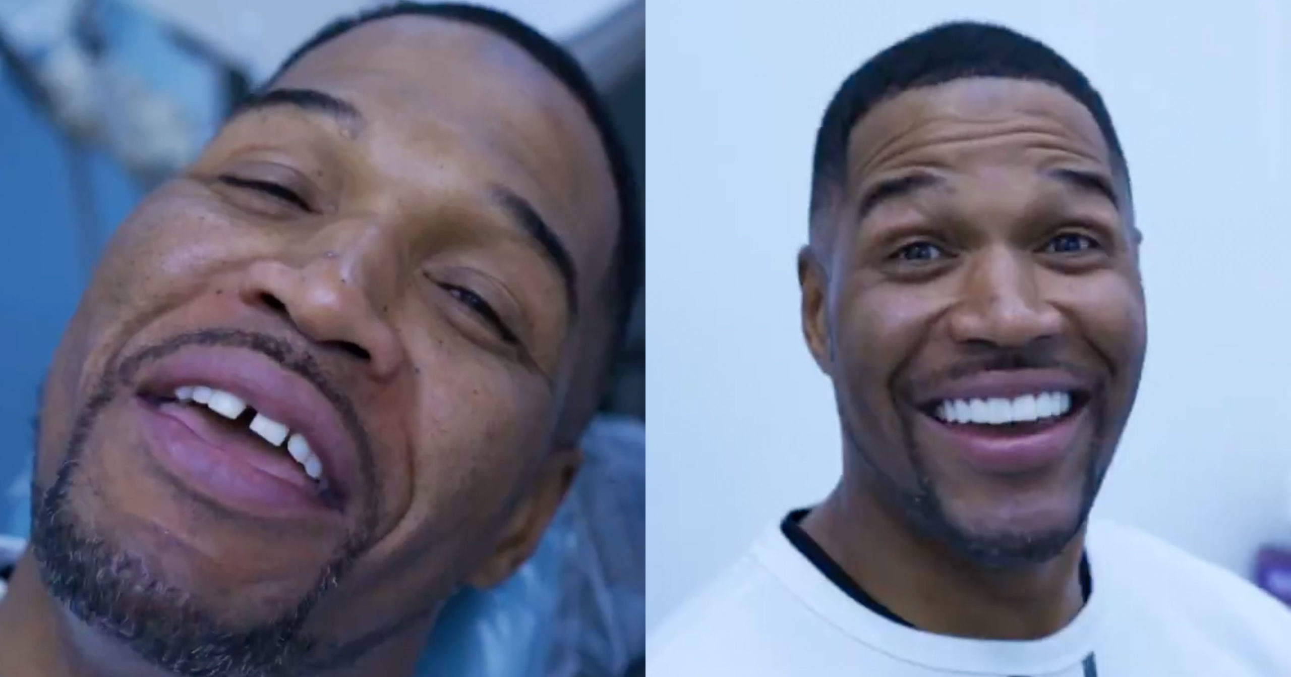 Michael Strahan Finally Gets Iconic Teeth Gap Corrected Video 