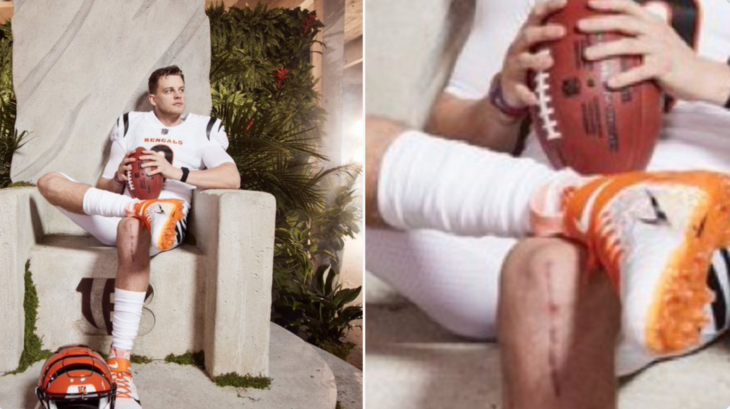 Joe Burrow Had The Perfect Response To Massive Scar From ACL Surgery -  Daily Snark