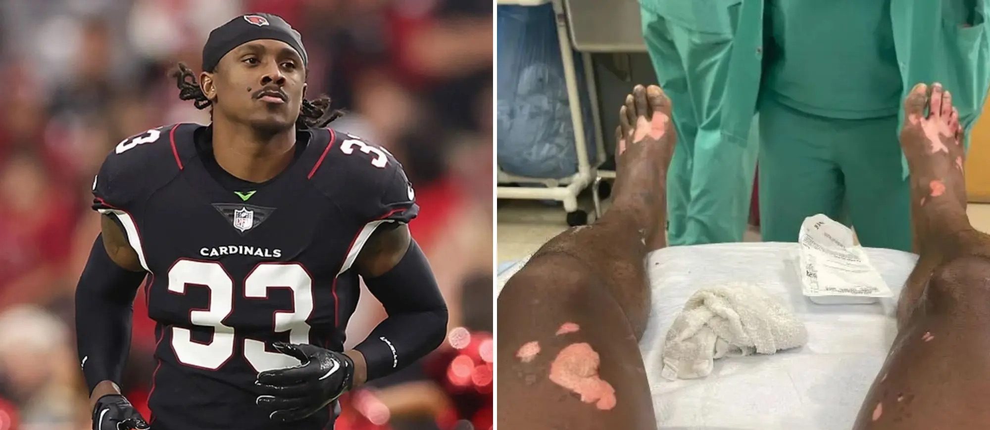 Cardinals CB Antonio Hamilton lands on NFI list after cooking accident