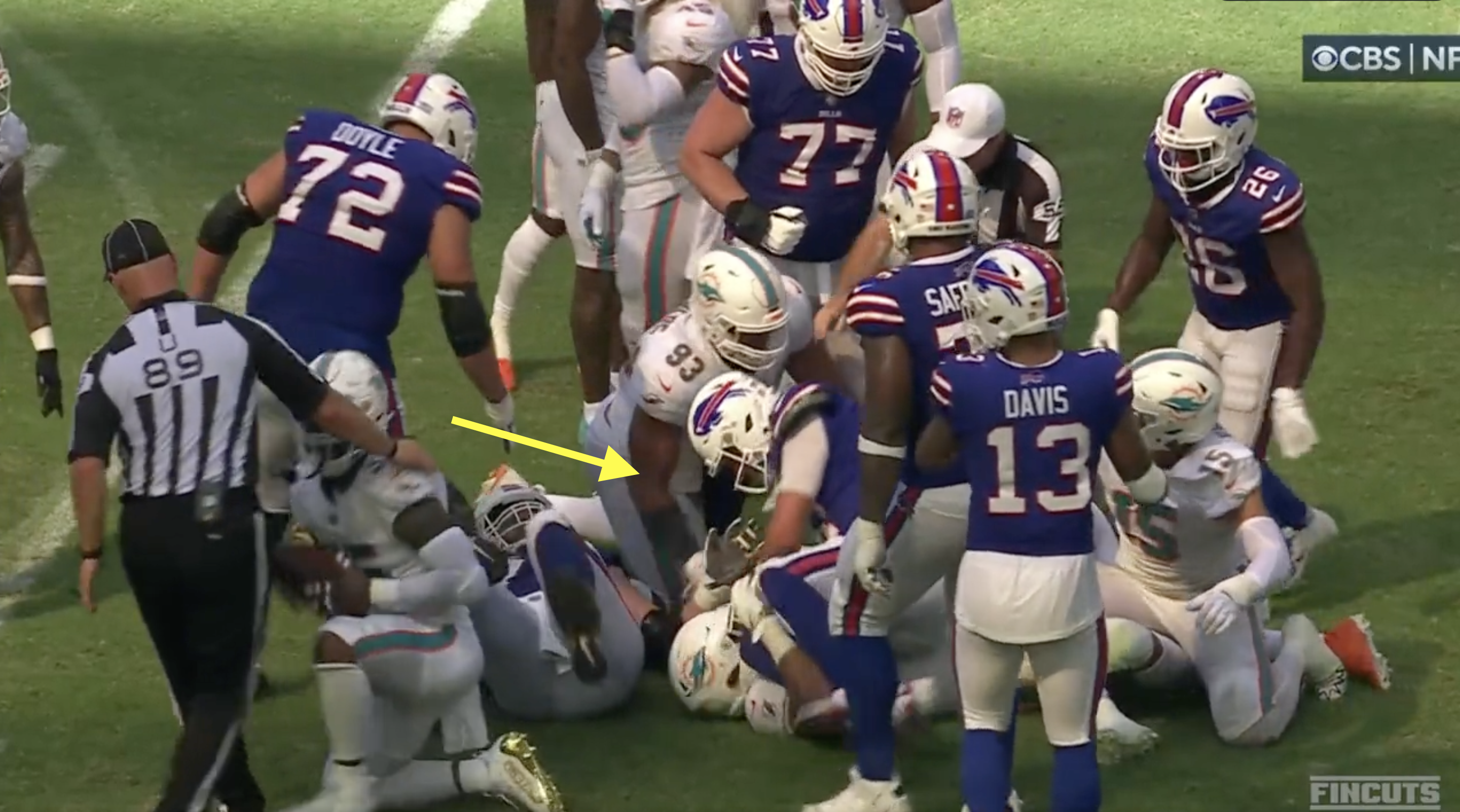 Josh Allen Ripped Helmet Off Miami Dolphins DT Christian Wilkins After He  Allegedly Grabbed His Private Part￼ - Daily Snark