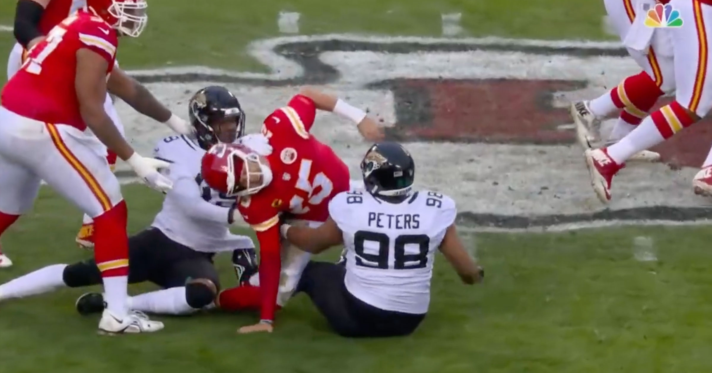 Chiefs QB Patrick Mahomes Suffers Serious-Looking Leg Injury (VIDEO)