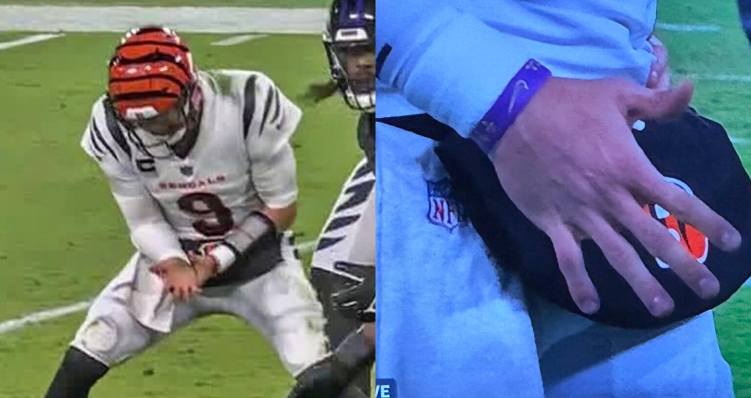 Close Up Photo Shows How Swollen Joe Burrow S Injured Hand Is Daily Snark